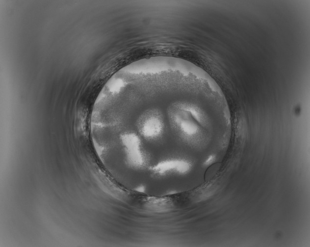 X0000116020185200912111401