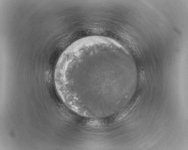 X0000116020177200912181157