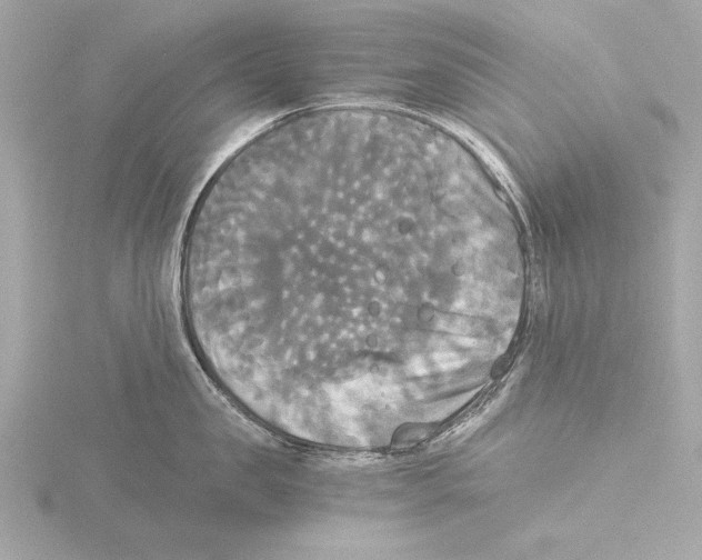 X0000116020957200912181147