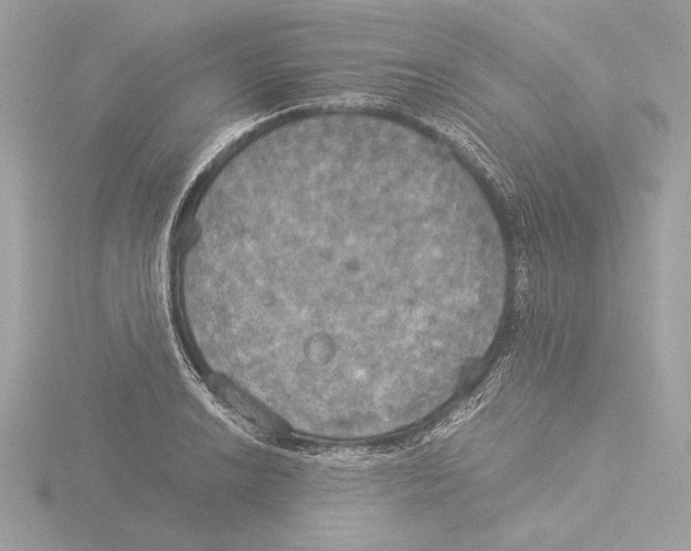 X0000116021038200912181145