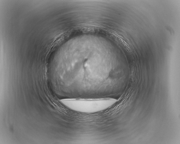 X0000116030964200911201251