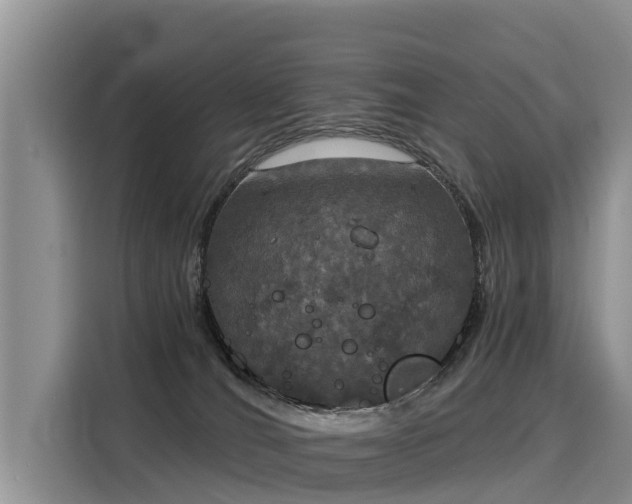 X0000116030036200911271145