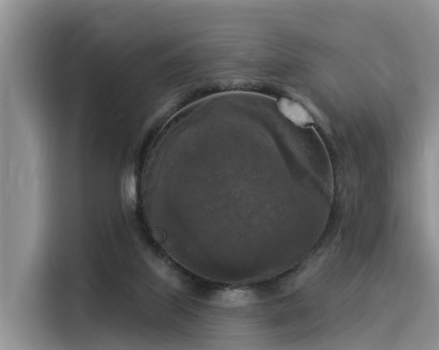 X0000116030067200911271144