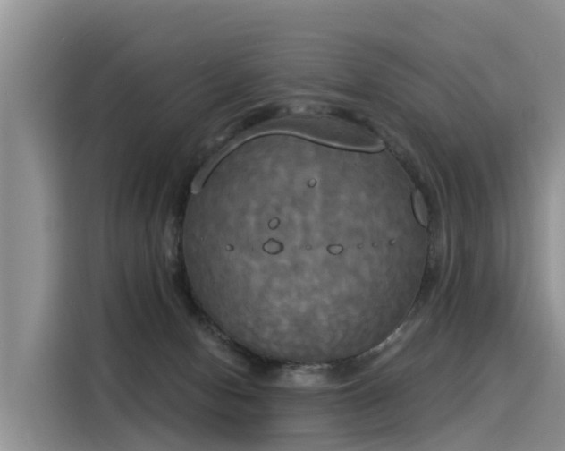 X0000116030078200911271144