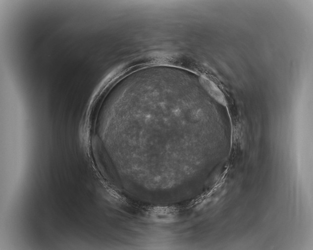 X0000116030101200911271144