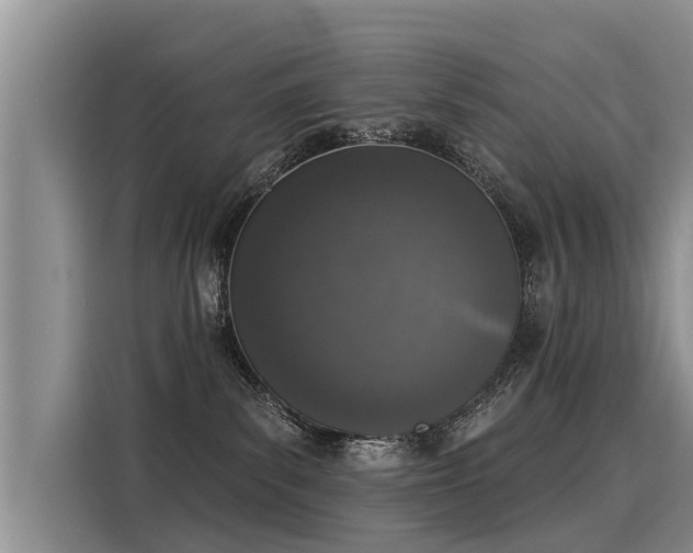 X0000116030139200911271143