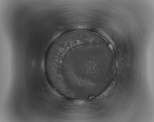 X0000116030249200911271141