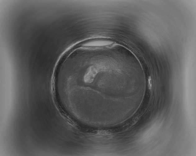 X0000116030388200911271140