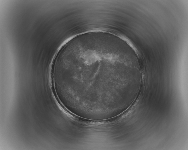 X0000116031143200911271131