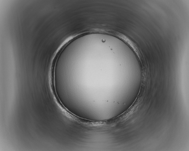 X0000116031147200911271131