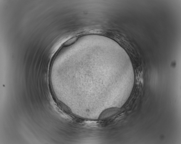 X0000116030052200912111425