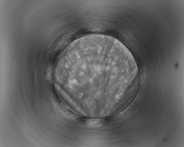 X0000116030175200912111424