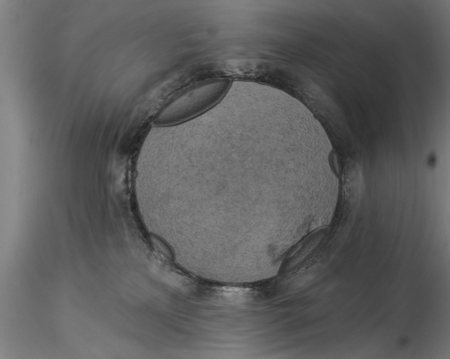 X0000116030233200912111423