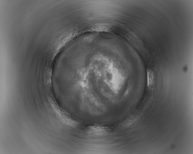 X0000116030300200912111422