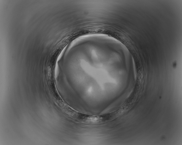 X0000116030375200912111421