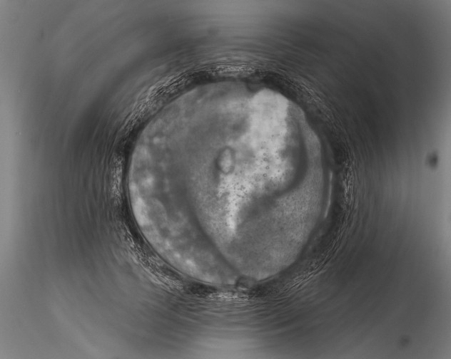 X0000116030745200912111415