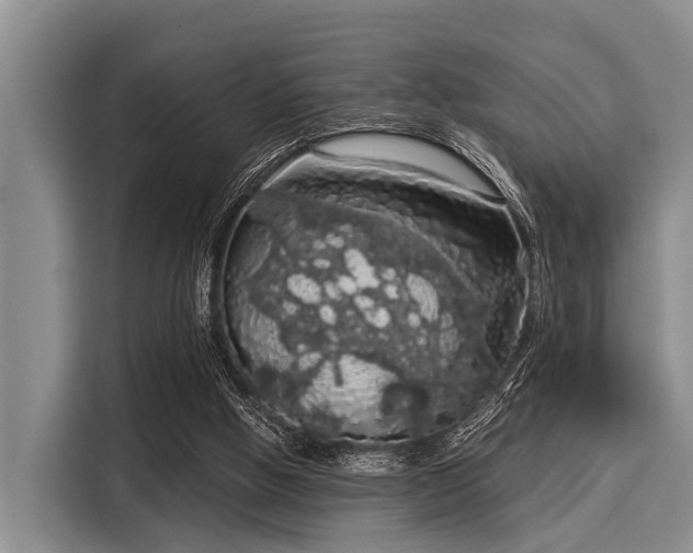 X0000116040058200911271206