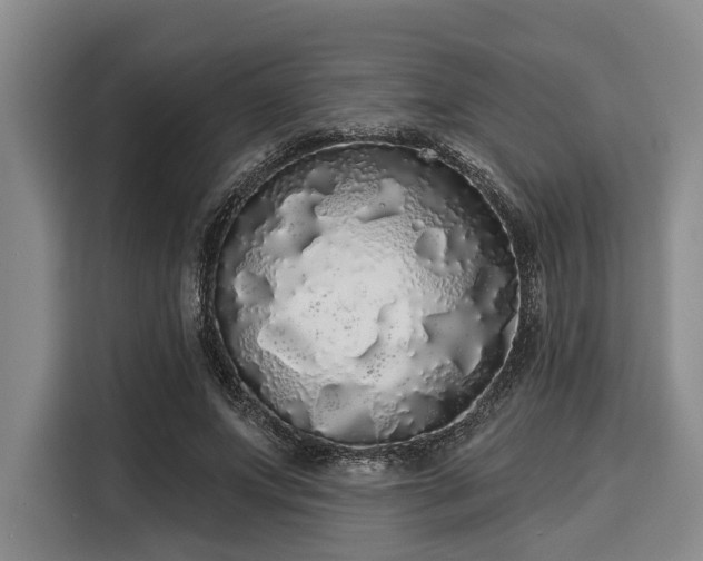 X0000116040687200911271158