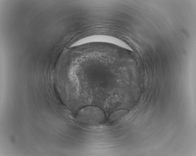 X0000116040475200912041815