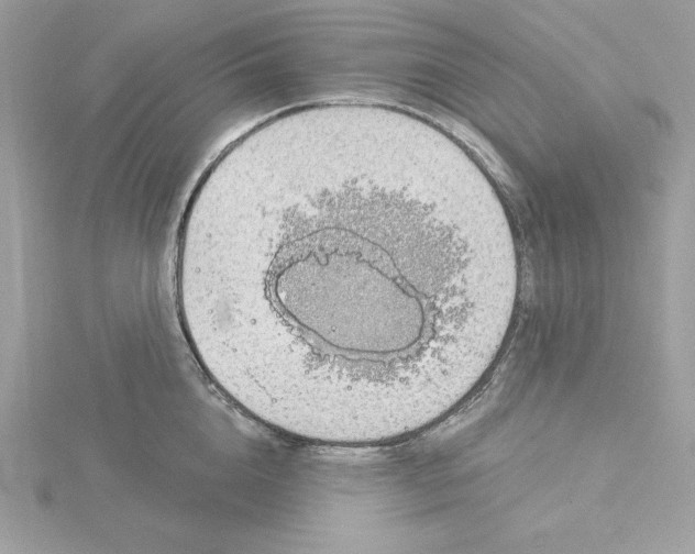 X0000116040856200912041810