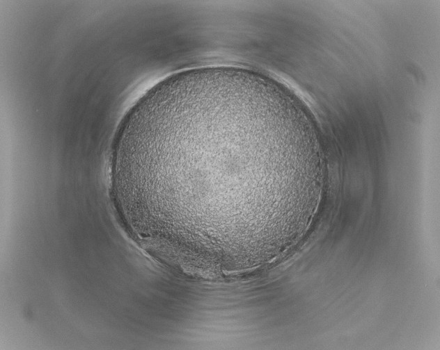 X0000116041415200912041801