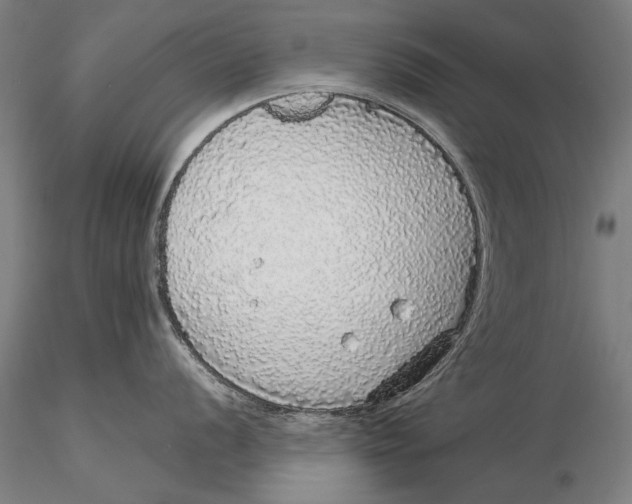 X0000116041056200912111435