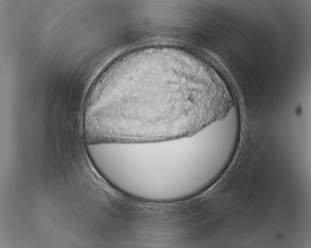 X0000116041236200912111432