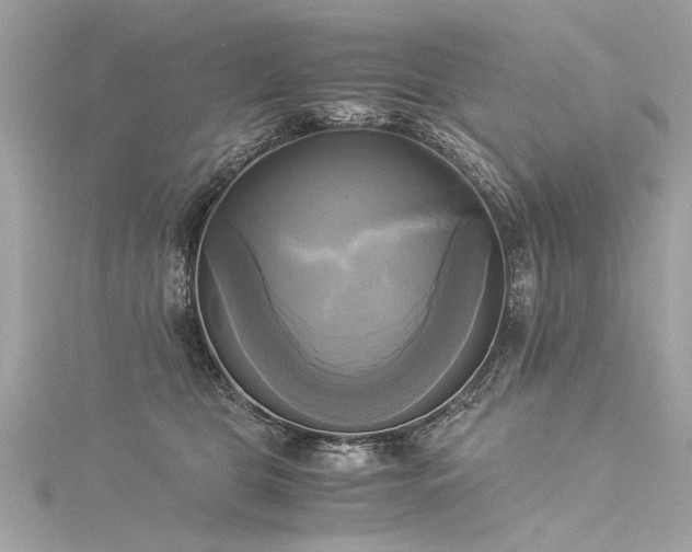 X0000116050469200911201410