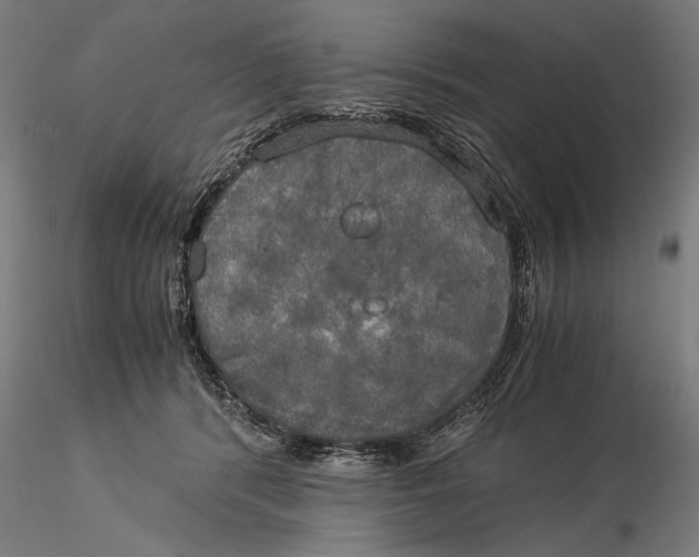 X0000116050416200912111509