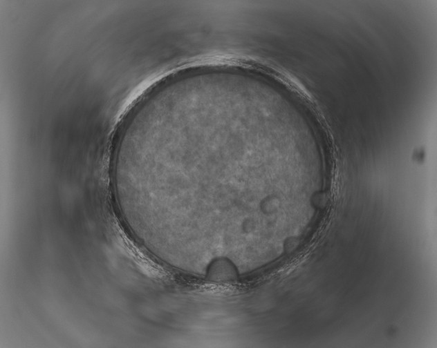 X0000116051216200912111456