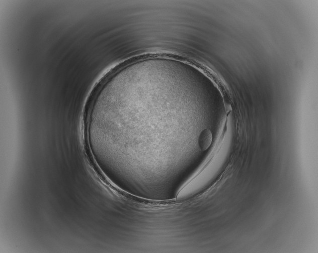X0000116061076200911271238