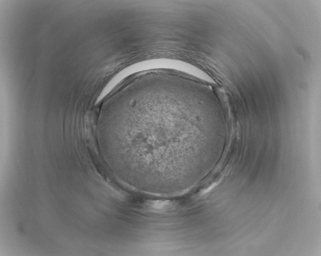 X0000116060575200912041856