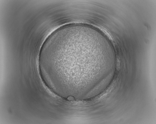 X0000116060895200912041851