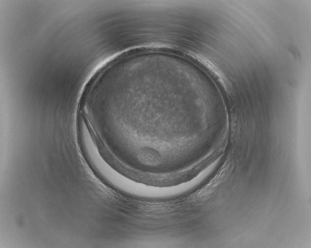 X0000116060935200912041851