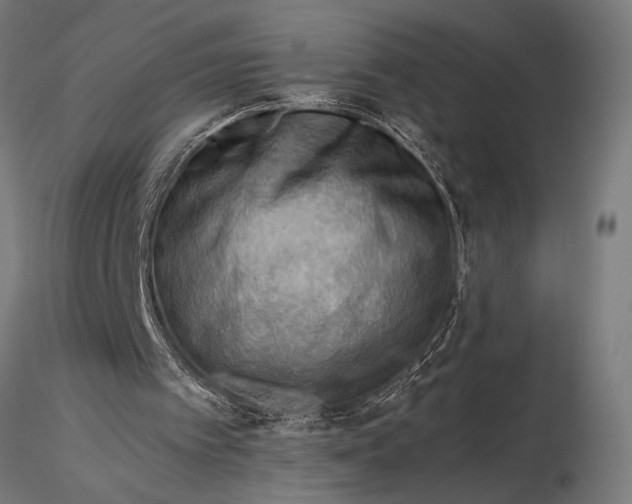 X0000116060097200912111537