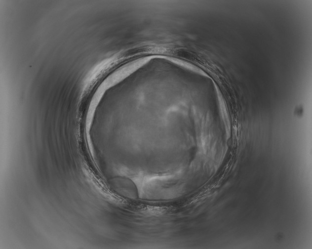 X0000116060149200912111536