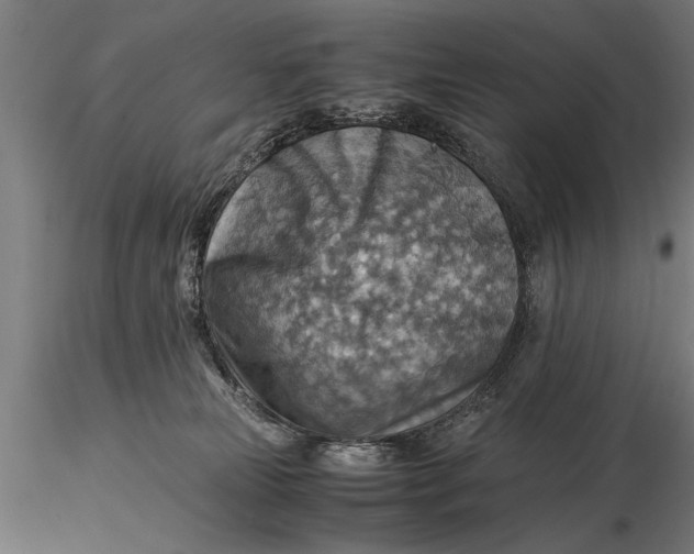 X0000116060181200912111536