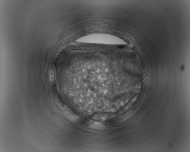 X0000116060285200912111535