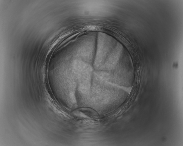 X0000116060290200912111535