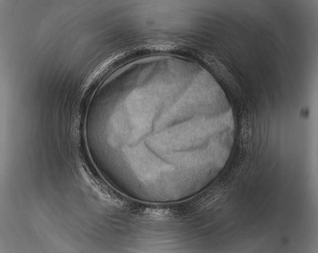 X0000116060440200912111532