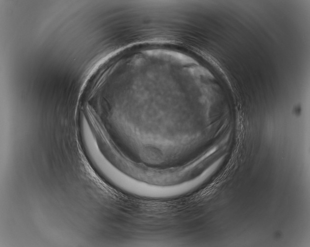 X0000116060935200912111524