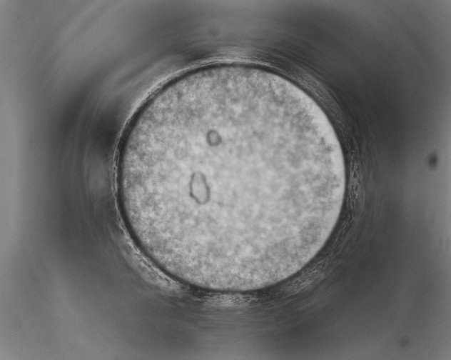 X0000116060950200912111525