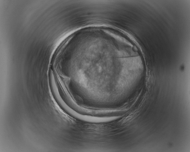 X0000116060951200912111525