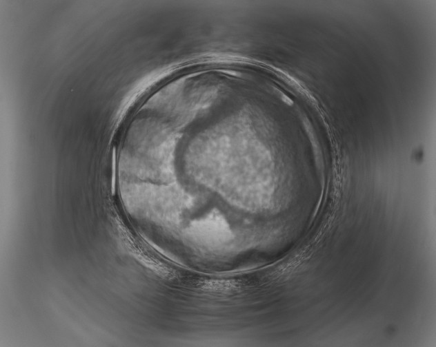 X0000116061223200912111520