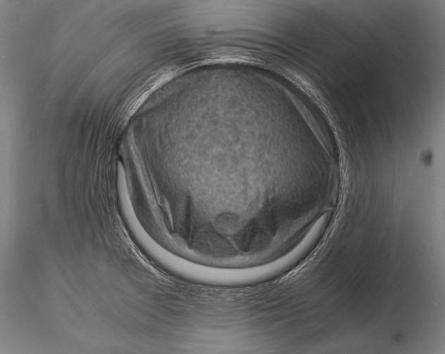 X0000116061377200912111517