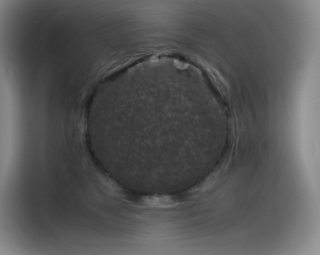 X0000116100517200911231128