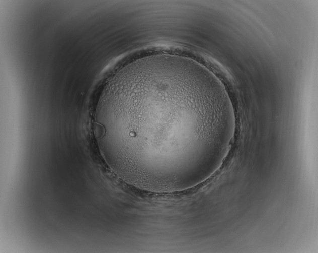 X0000116100776200911231125