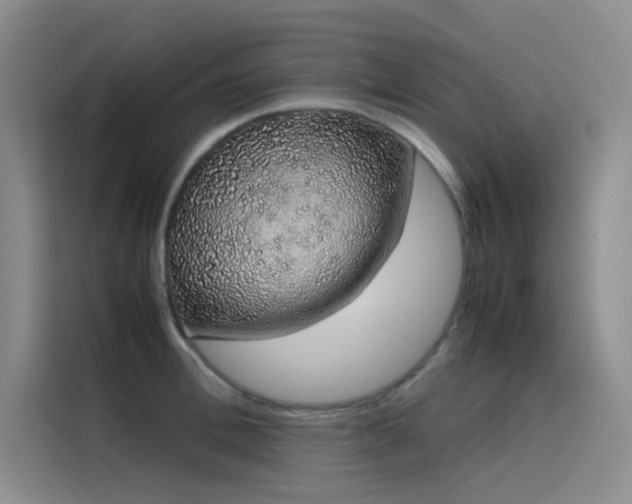 X0000116100996200911231122