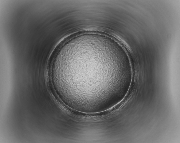 X0000116100976200911301059