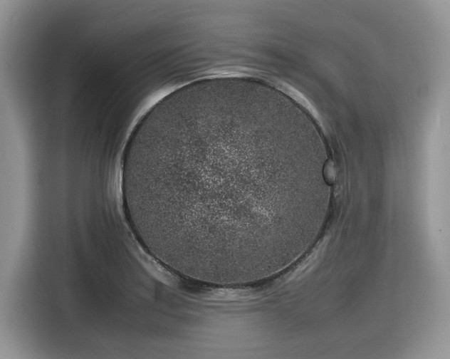 X0000116101179200911301056